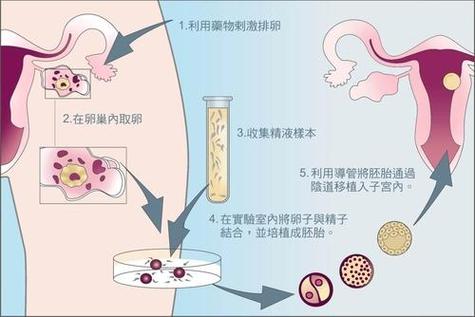 供卵试管婴儿宝宝便秘有什么症状